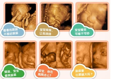 让宝宝拥有较完整的0岁相册,留下有效的记忆